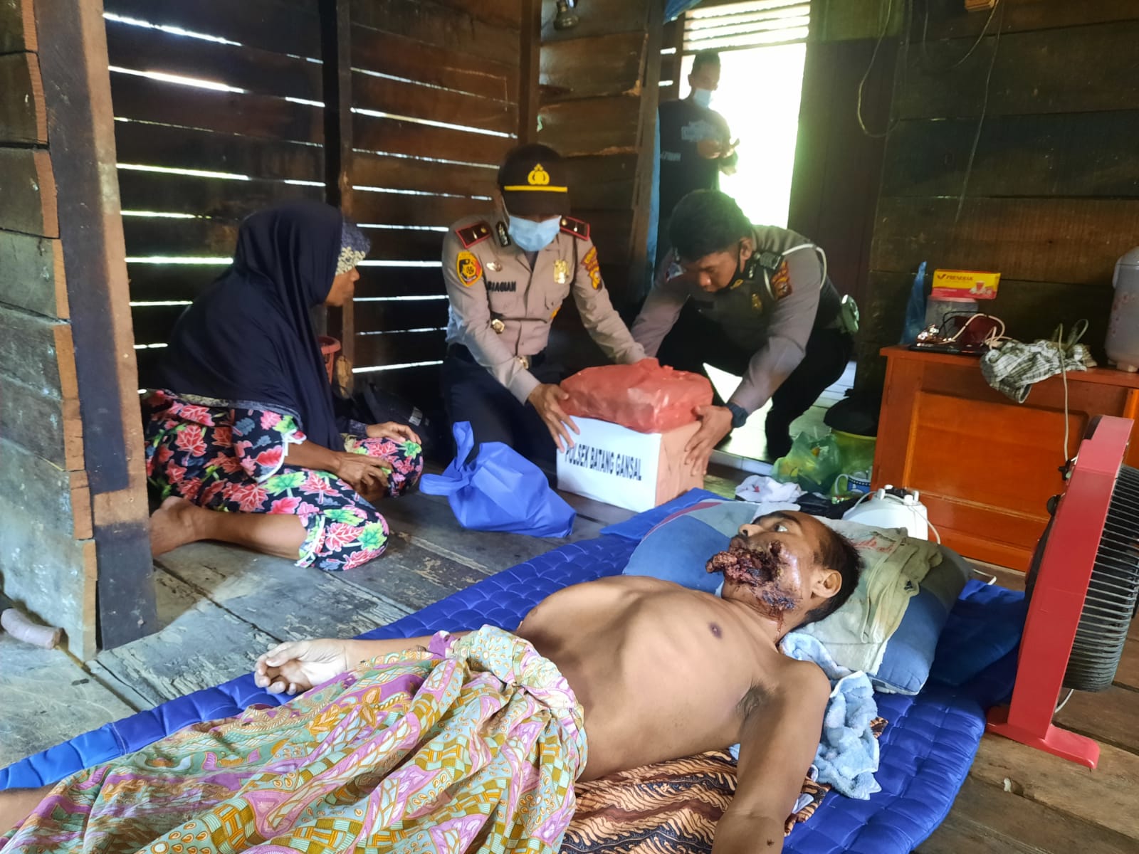 Polsek Batang Gansal Giat Jubah Emas di Kediaman Bapak Marsid Penderita Tumor Bibir