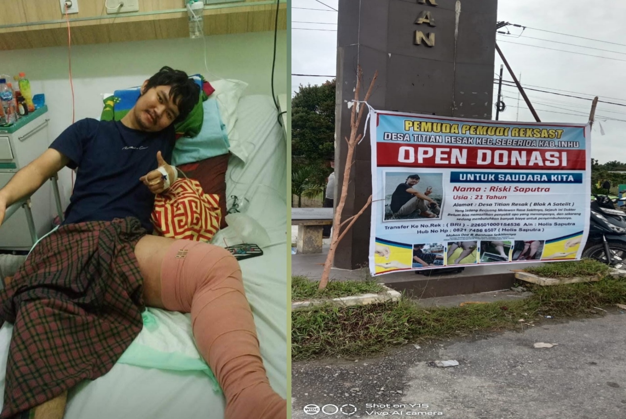 Yo, Berdonasi Untuk Kesembuhan Risky Syaputra Yang Mengalami Pembengkakan Dibagian Kakinya