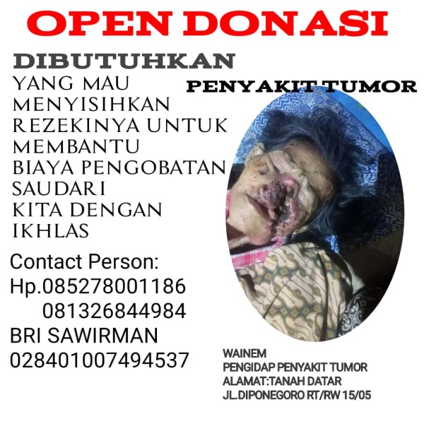 Derita Bu Wainem, Pengidap Tumor Ganas di Rengat Barat Butuh Uluran Tangan