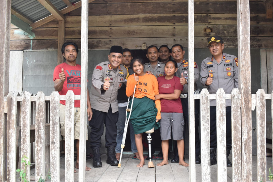 Kapolres Inhu Wujudkan Impian Julita Untuk Miliki Kaki Palsu